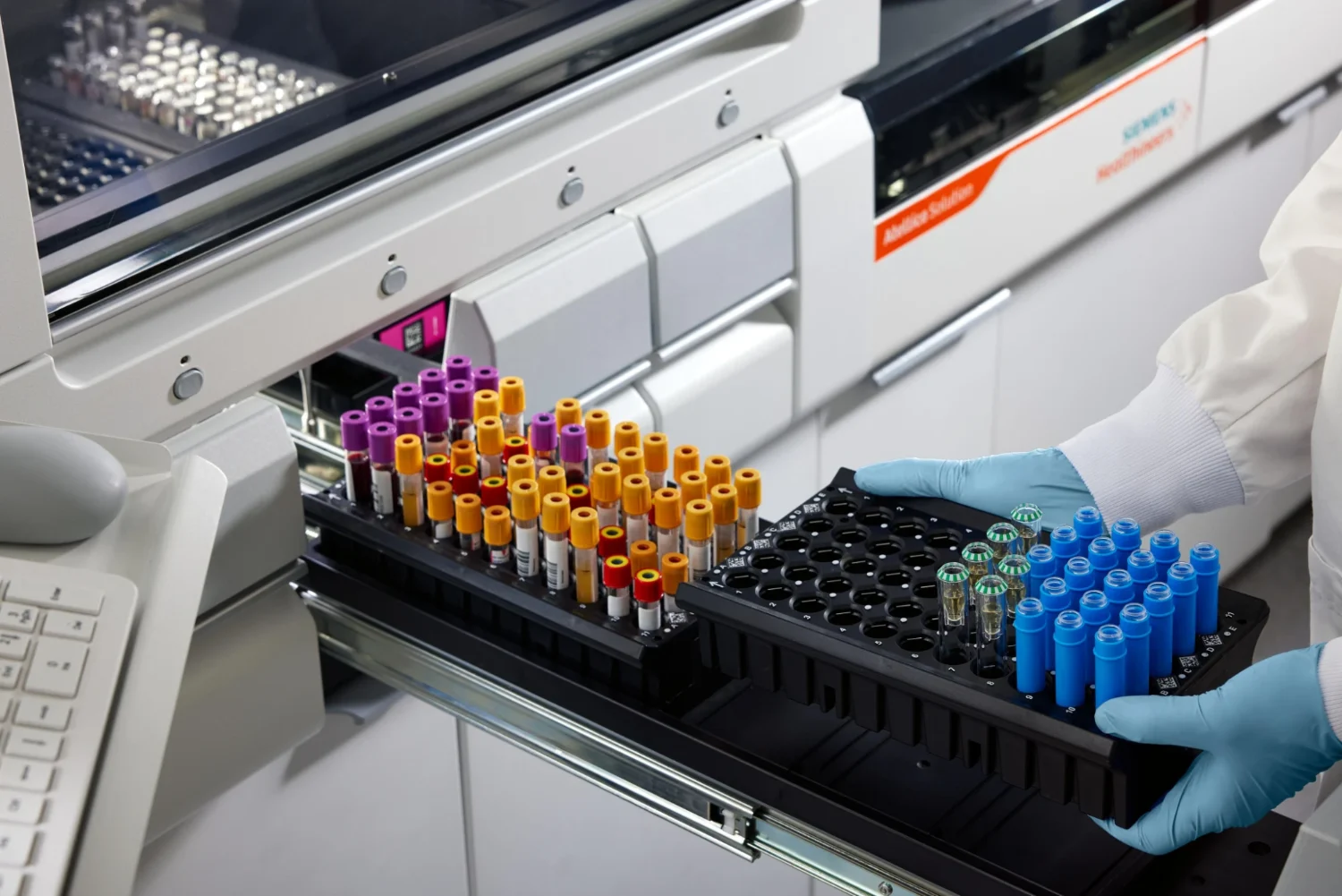 Gloved hands loading a rack of sample tubes into a laboratory analyzer