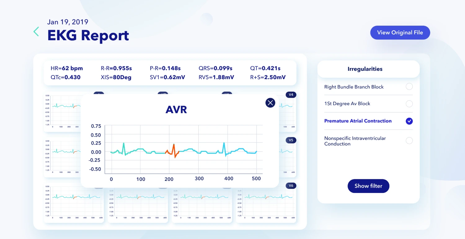 An EKG report screen with lead waveforms, interval measurements and a list of flagged irregularities